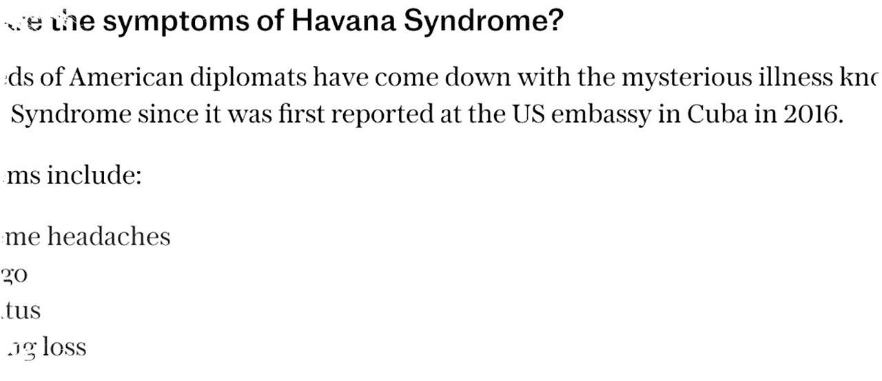 Ilmuwan Norwegia Ciptakan Mesin untuk Menyangkal Havana Syndrome, Malah Alami Kerusakan Otak Serupa Setelah Tes Rahasia pada Diri Sendiri