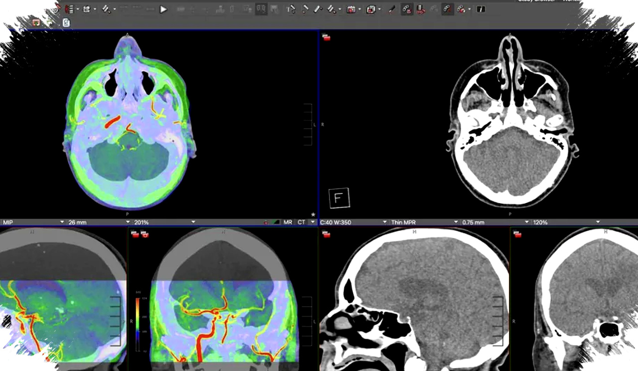 Studio Display XDR Hadirkan Dukungan DICOM Revolusioner, Tantang Dominasi Monitor Medis Super Mahal dan Proses Sertifikasi FDA Sedang Berlangsung