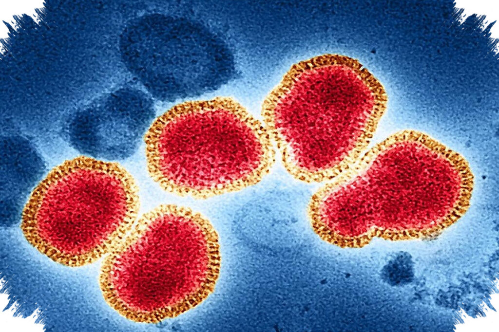 Influenza A Menyebar Cepat, Fakta Penularan Dan Cara Mencegahnya Sebelum Terlambat