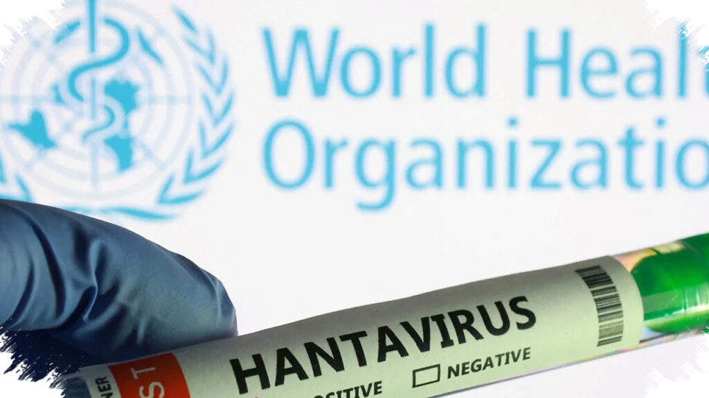 Israel Umumkan Kasus Pertama Hantavirus, Pasien Stabil Tapi Tetap Dipantau Medis