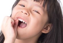 Gigi Berlubang Bukan Sekadar Nyeri, Diam-Diam Mengganggu Tumbuh Kembang Anak