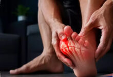 Asam Urat Tinggi Bisa Menyusun Batu Ginjal, Ini Mekanisme Yang Sering Terlewat