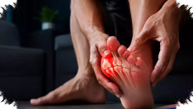 Asam Urat Tinggi Bisa Menyusun Batu Ginjal, Ini Mekanisme Yang Sering Terlewat