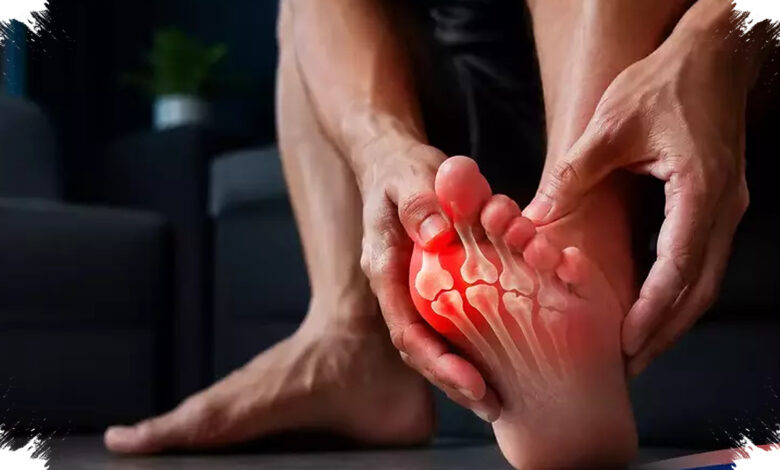 Asam Urat Tinggi Bisa Menyusun Batu Ginjal, Ini Mekanisme Yang Sering Terlewat