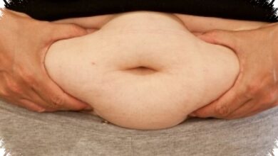 Obesitas Bukan Sekadar Gemuk, Ini Penyakit Serius yang Bisa Picu Jantung dan Kanker