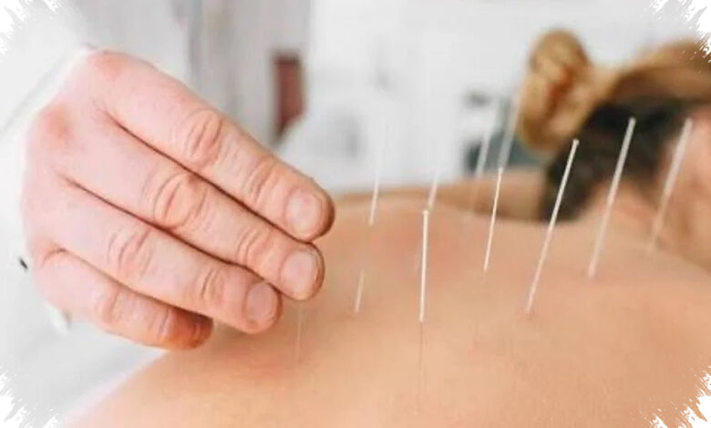 Akupuntur Bisa Meredakan Cemas, Tapi Efeknya Tak Sama untuk Semua Orang