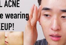 Cushion vs Foundation untuk Kulit Berjerawat, Mana yang Lebih Aman Dipakai?
