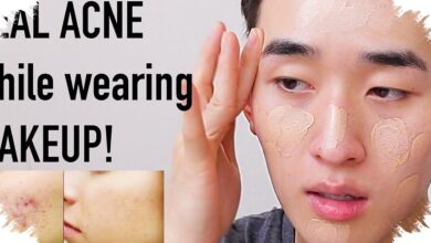 Cushion vs Foundation untuk Kulit Berjerawat, Mana yang Lebih Aman Dipakai?