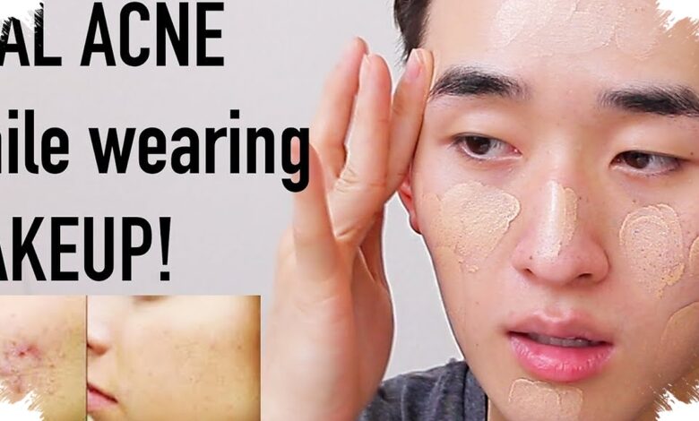 Cushion vs Foundation untuk Kulit Berjerawat, Mana yang Lebih Aman Dipakai?