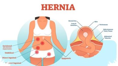 Hernia pada Anak Tak Bisa Sembuh Sendiri, Benjolan Kecil Ini Perlu Diwaspadai