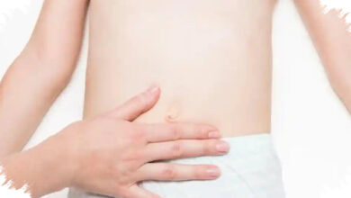 Benjolan Naik-Turun di Paha atau Pusar Anak Bisa Jadi Hernia, Ini Tanda Bahayanya