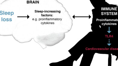 5 Sistem Tubuh yang Bisa Terganggu Saat Kekurangan Tidur, Jantung hingga Otak