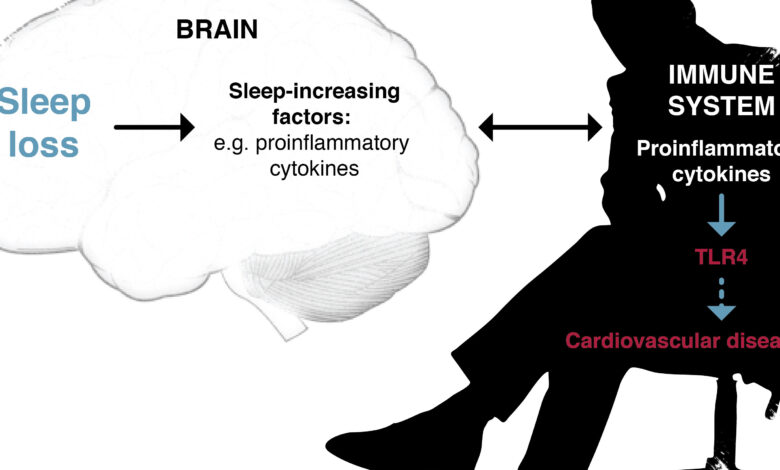 5 Sistem Tubuh yang Bisa Terganggu Saat Kekurangan Tidur, Jantung hingga Otak