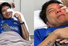 Desta Jalani Operasi Penyedotan Darah di Mata Usai Kena Bola Padel