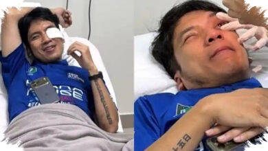 Desta Jalani Operasi Penyedotan Darah di Mata Usai Kena Bola Padel