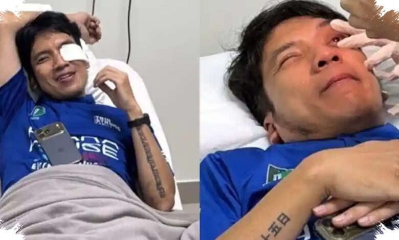 Desta Jalani Operasi Penyedotan Darah di Mata Usai Kena Bola Padel