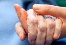 Tanda Kematian di Tangan dan Kaki, Ini Perubahan Tubuh yang Sering Muncul Terlebih Dulu