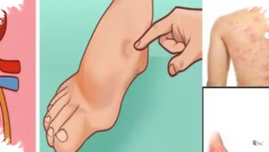 7 Kebiasaan yang Diam-diam Bisa Merusak Ginjal, Bukan Hanya Diabetes dan Tekanan Darah Tinggi