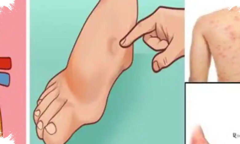 7 Kebiasaan yang Diam-diam Bisa Merusak Ginjal, Bukan Hanya Diabetes dan Tekanan Darah Tinggi