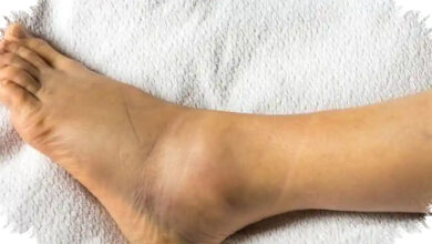 8 Tanda Tubuh Kelebihan Garam, dari Kaki Bengkak hingga Jantung Berdebar