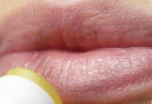 Bibir Terasa Makin Kering setelah Lip Balm? Kandungan Ini Bisa Jadi Pemicunya