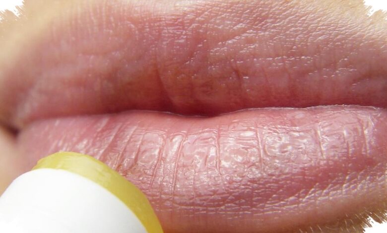 Bibir Terasa Makin Kering setelah Lip Balm? Kandungan Ini Bisa Jadi Pemicunya