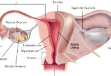 Lahir Tanpa Serviks dan Vagina, Remaja 18 Tahun Ini Jalani Rekonstruksi Rumit