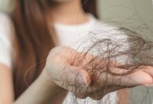 Rambut Lebih Mudah Rontok saat Cuaca Panas, Keringat Bisa Mengganggu Folikel
