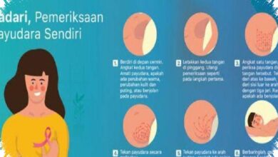 Terapi Presisi Buka Harapan Hidup Lebih Panjang bagi Pasien Kanker Perempuan